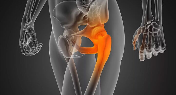 Infectious hip pain requiring antibiotic treatment