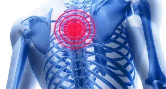 Treatment of the osteocondrosis of the thoracic spine