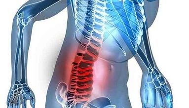 Signs and symptoms of lumbar osteochondosis